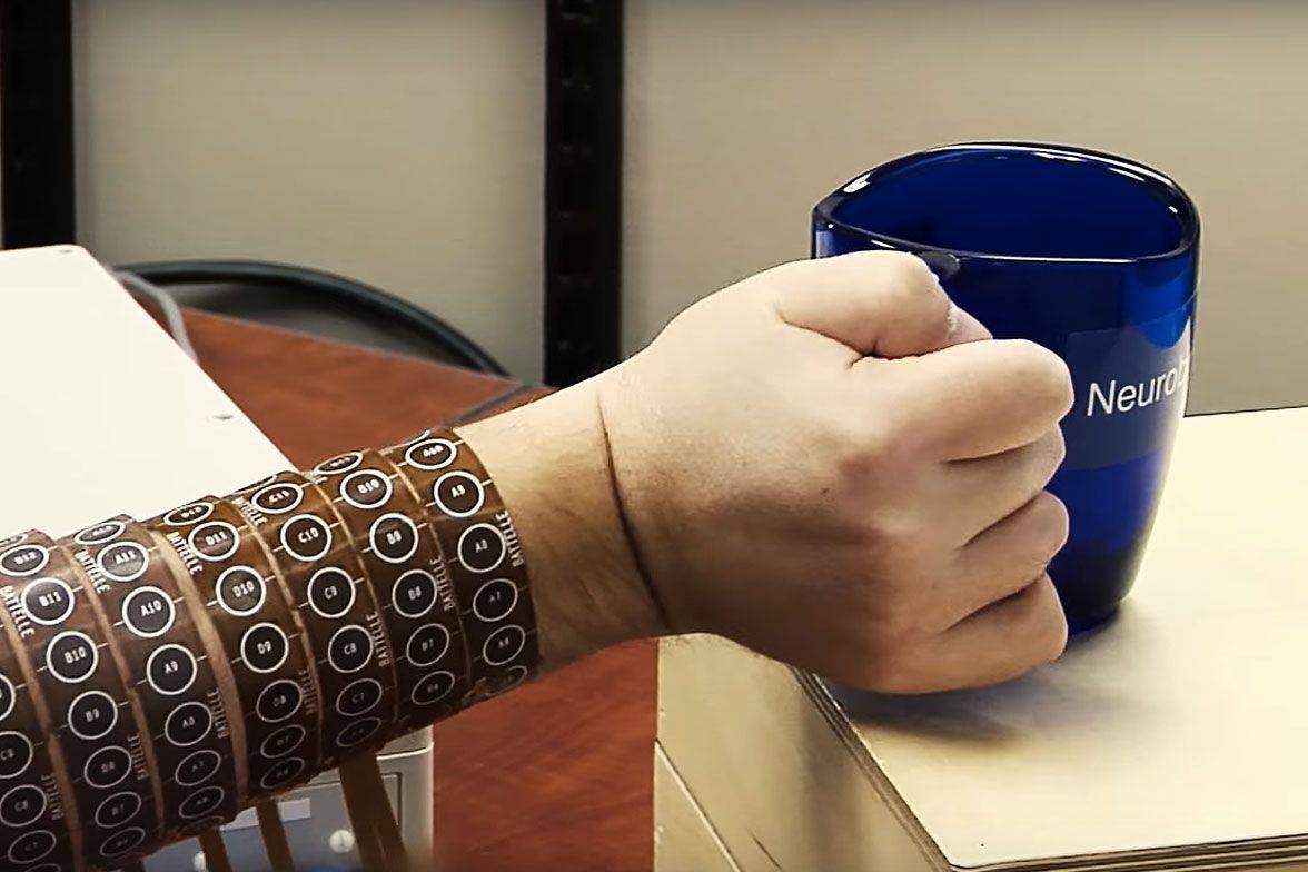 Quadriplegic’s arm comes back to life