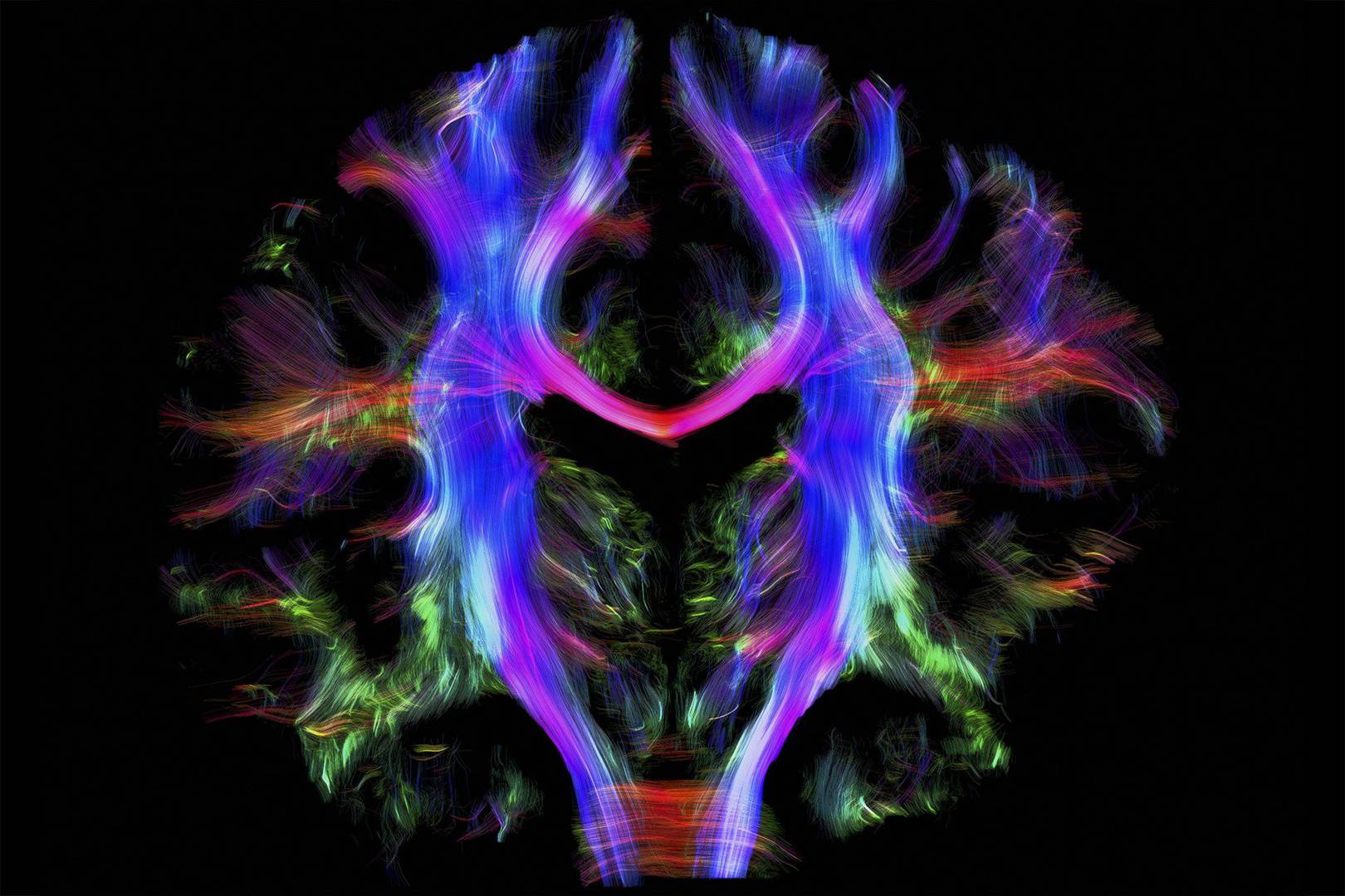 The brain has a ‘generosity centre,’ scientists say