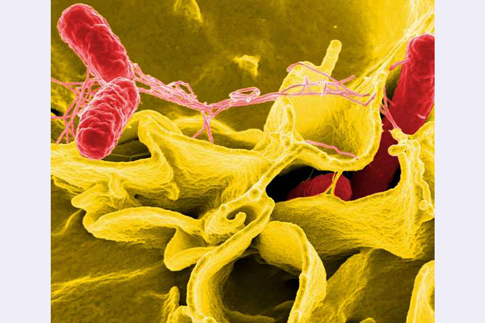 Training microbes to hunt out cancer and pollutants