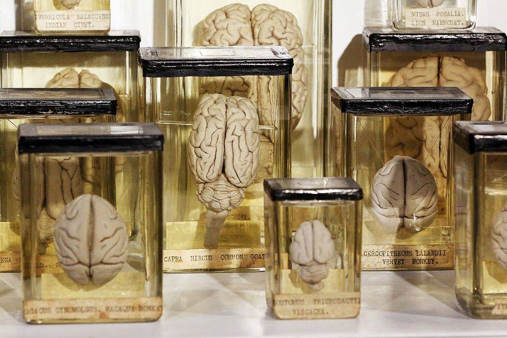 There's a 'switch' in our brains that wakes us up