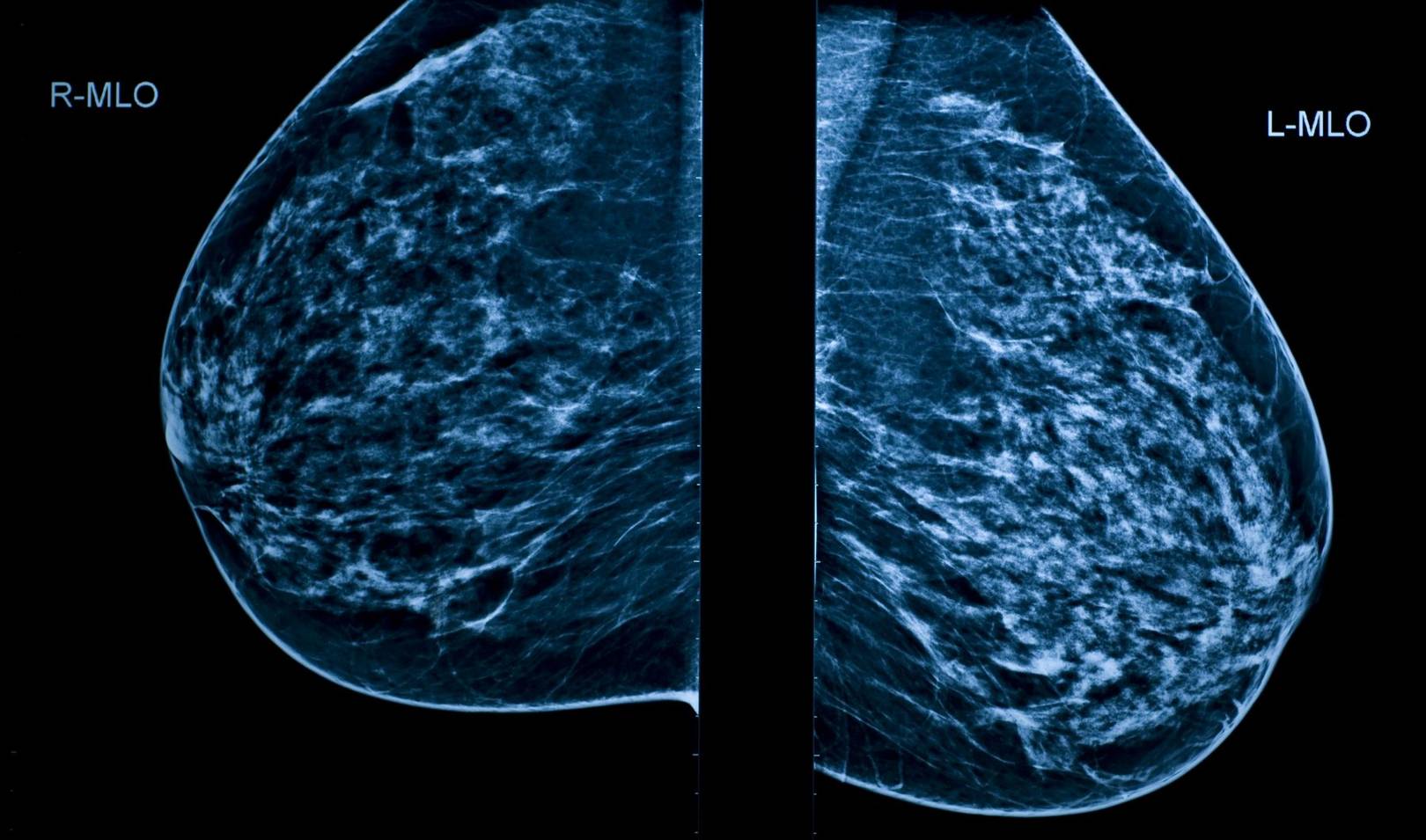This AI software can tell if you're at risk from cancer before symptoms appear