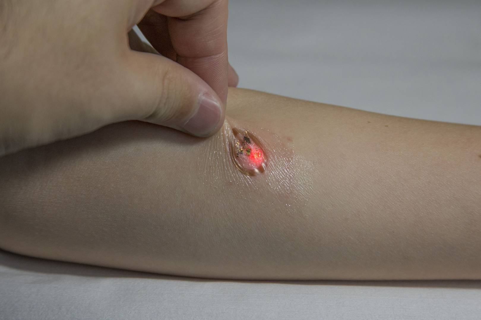 Stretchy 'pad' turns your arm into the ultimate flexible touchscreen