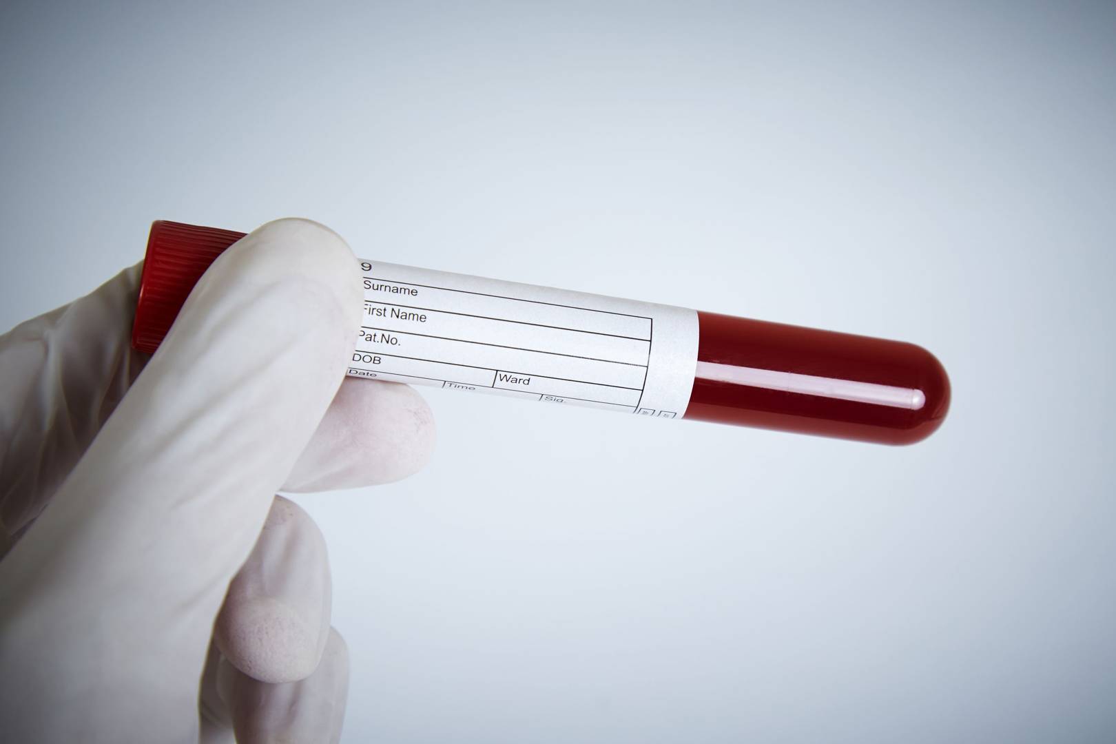 Cancer has a new enemy. This blood test hunts down even the earliest traces of the disease