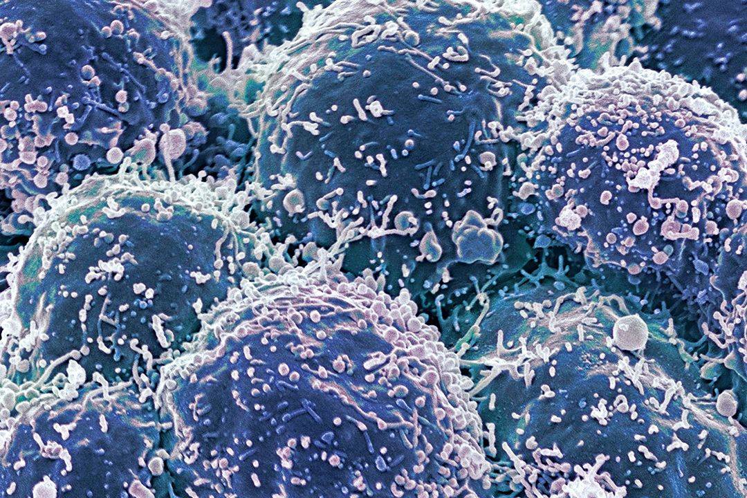 'Anti-evolution' drugs could be the key to finally curing cancer