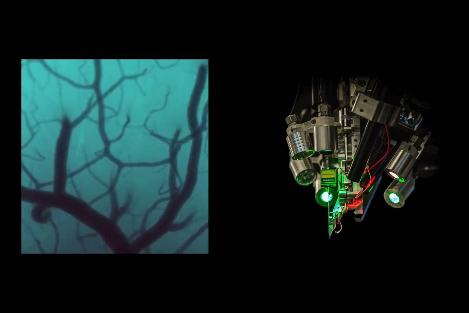 Wednesday briefing: Neuralink's brain-computer interface is preparing for human trials