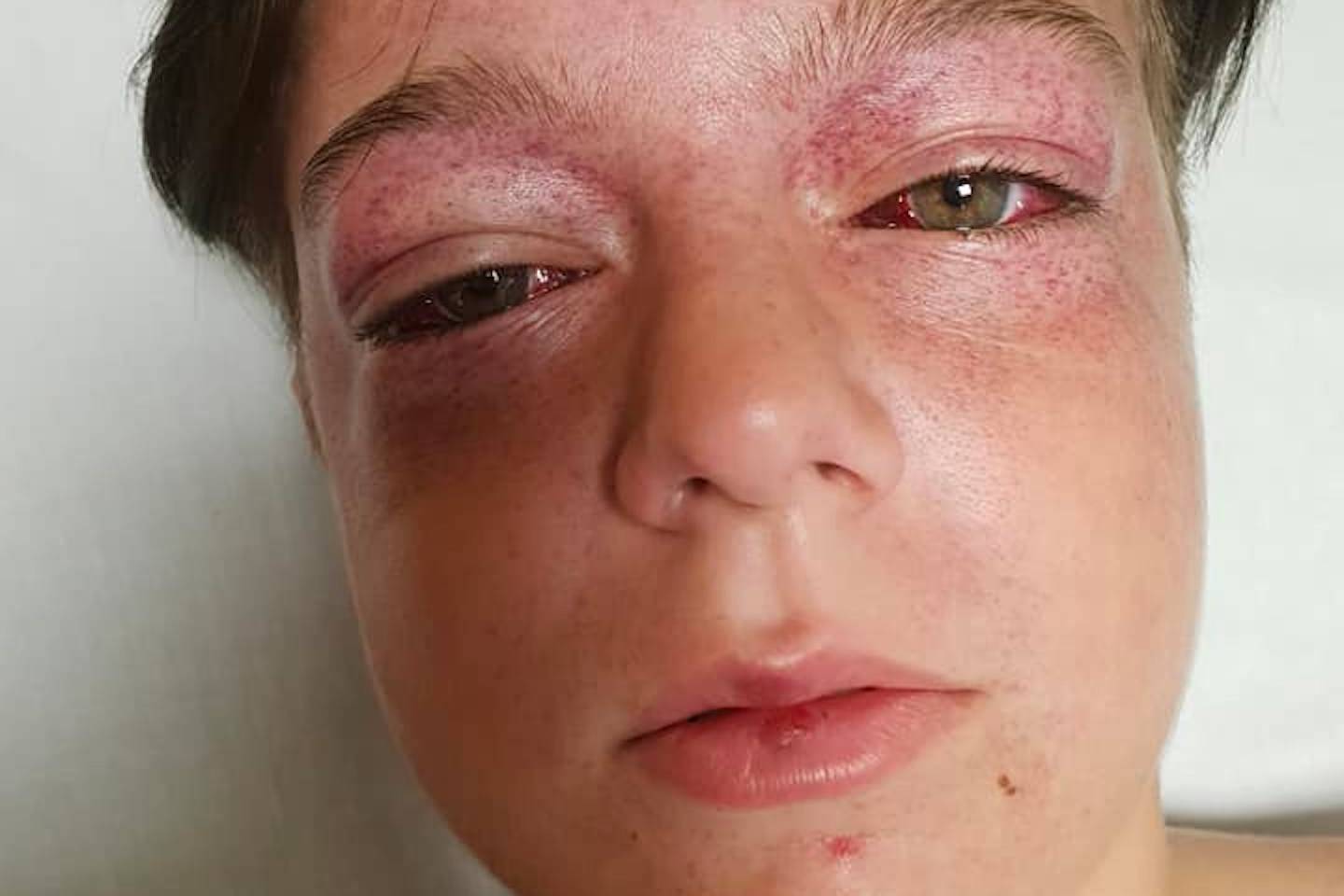 The roundabout of death and why people hurt themselves for memes