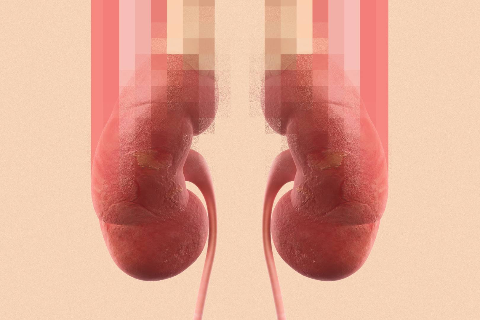 DeepMind's new AI predicts kidney injury two days before it happens