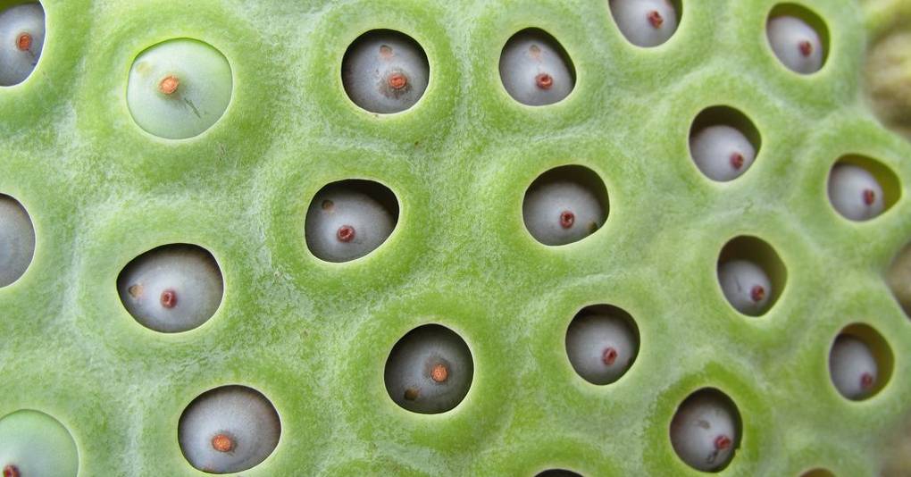 What is Trypophobia and what causes fear of bubbles and tiny holes