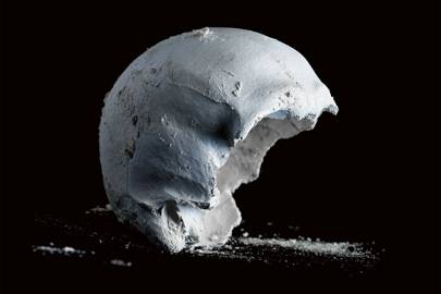 The skull's job is to protect the brain, making it the hardest body part to deal with