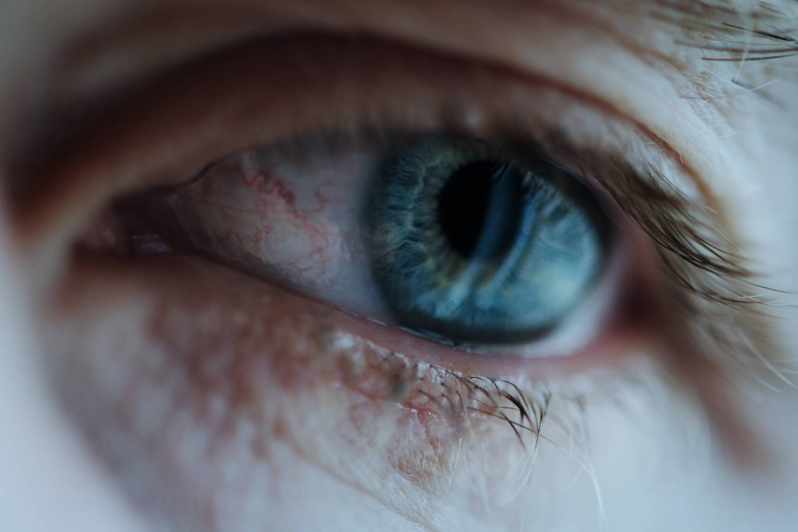 After 15 years in a vegetative state, an implant makes a man cry again