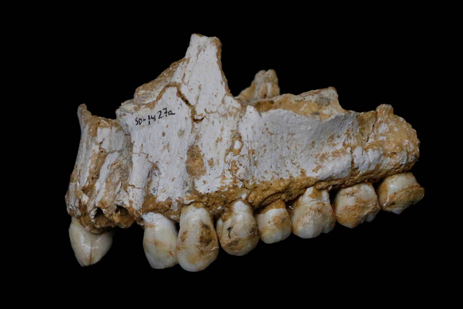 Neanderthal teeth reveal they ate woolly rhinos and may have used plants as primitive painkillers