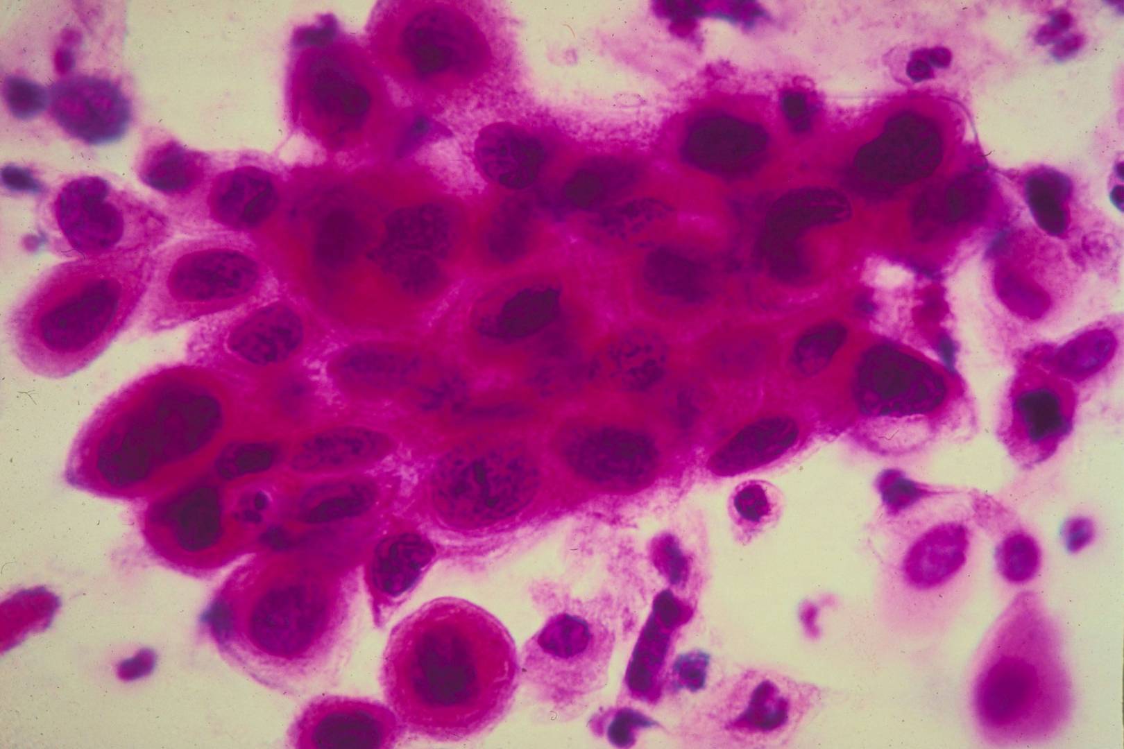 This AI doctor knows what's wrong with you by checking your genome