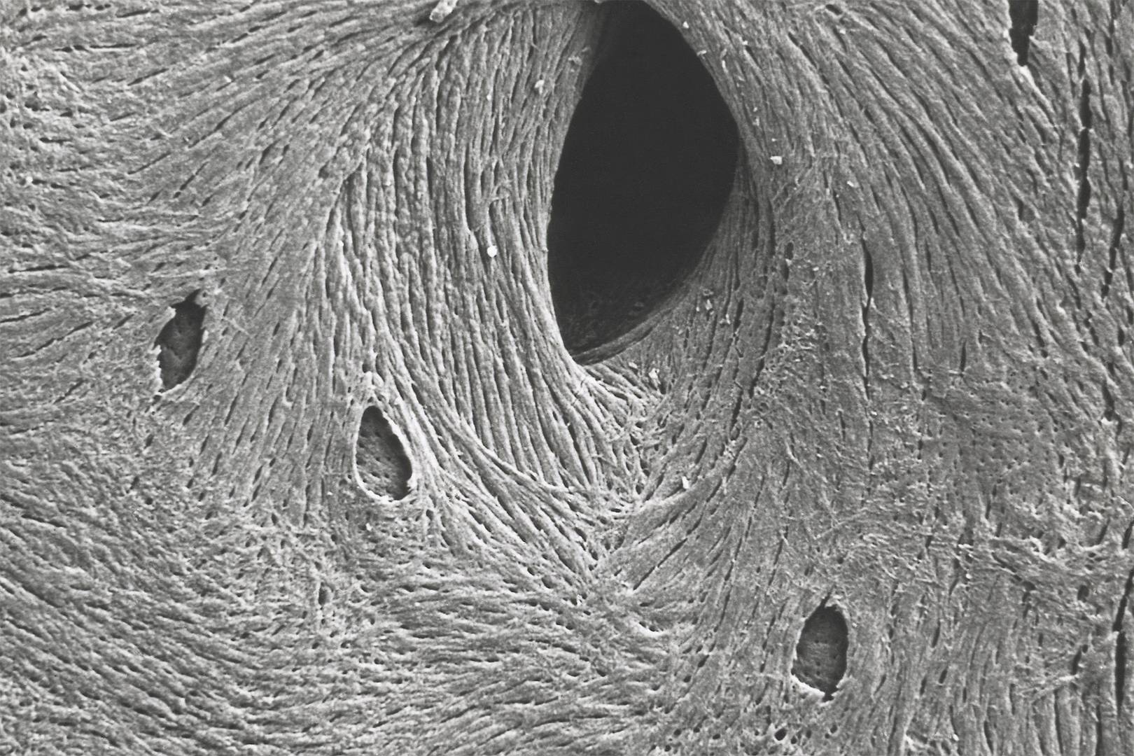 How do you grow bone in a lab? Look to gravitational waves