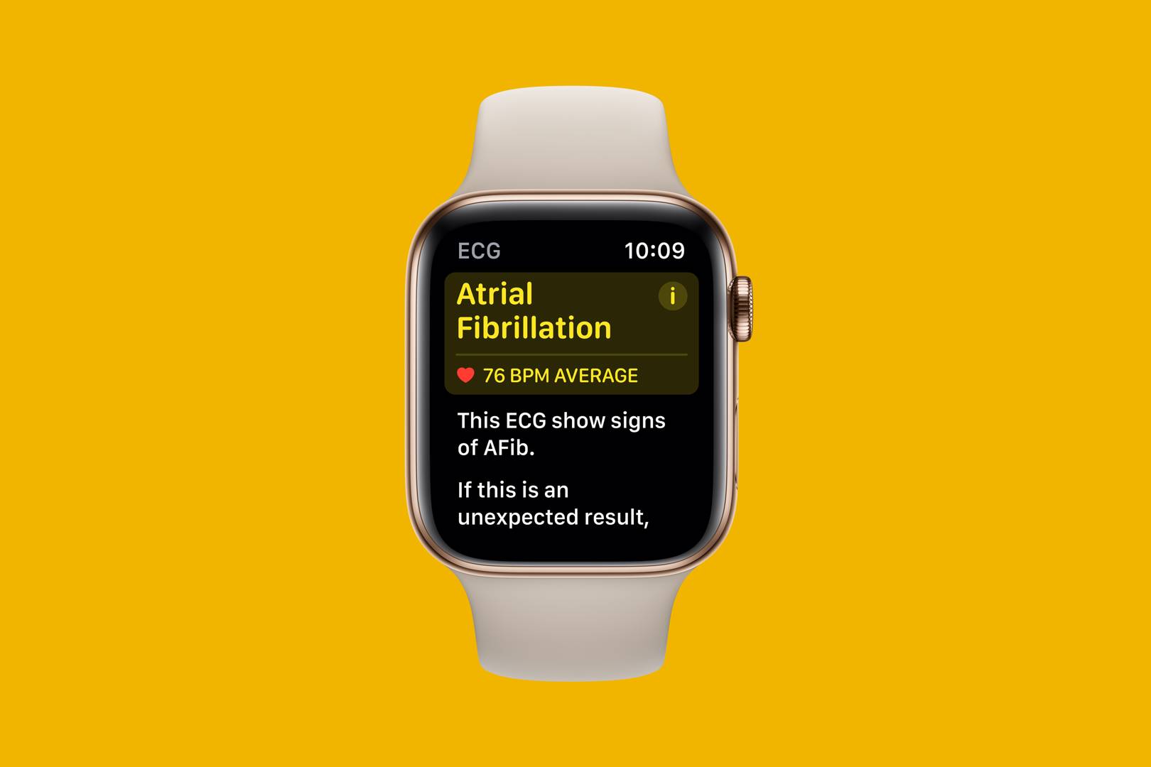 You can finally use the Apple Watch's ECG tracker in the UK