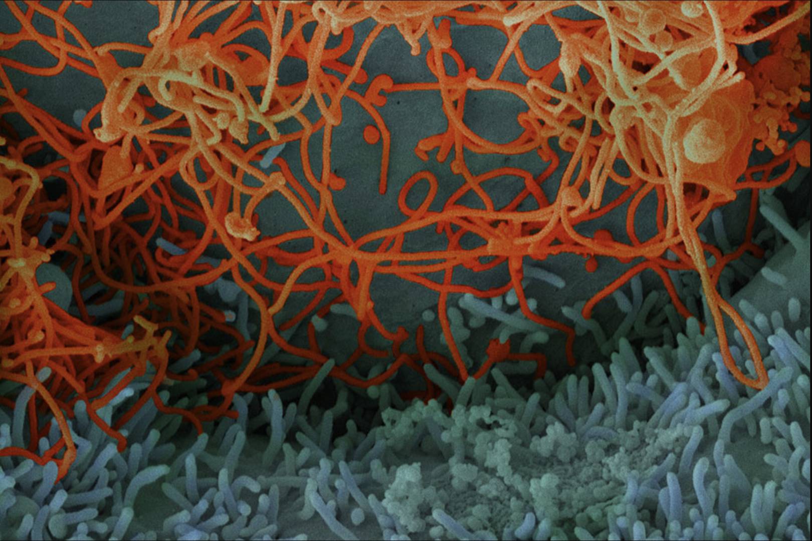 Up close the Ebola virus is finally revealing its deadly secrets | WIRED UK