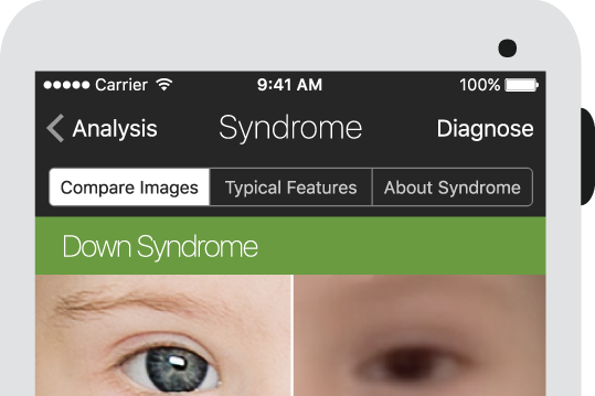 Your face could reveal if you have a rare disease