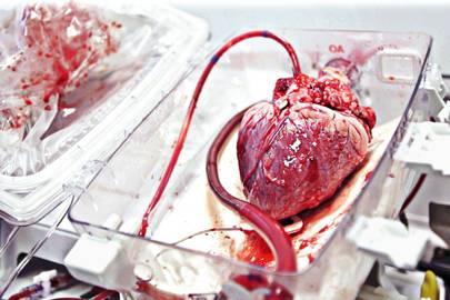 TransMedics keeps human hearts beating for up to 10 hours | WIRED UK