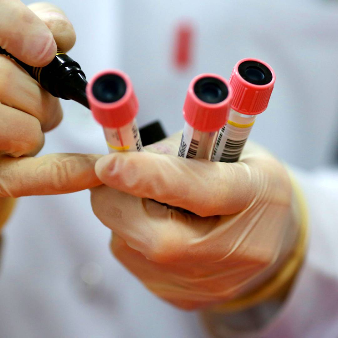 Image: How CRISPR is helping scientists create a better coronavirus test