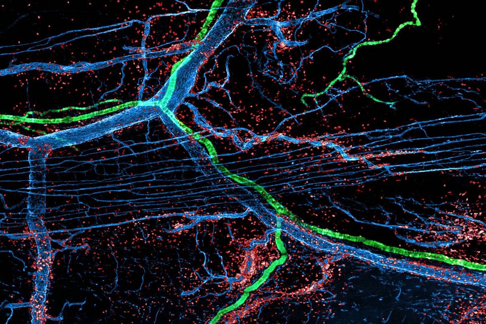 Peering inside a deadly wound has never looked so pretty