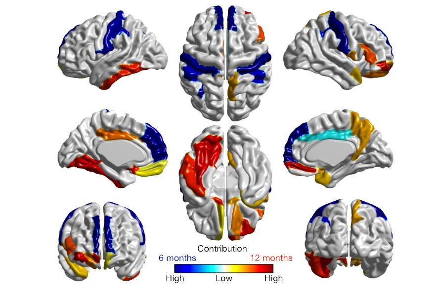 This algorithm can spot signs of autism in children a year before they're diagnosed