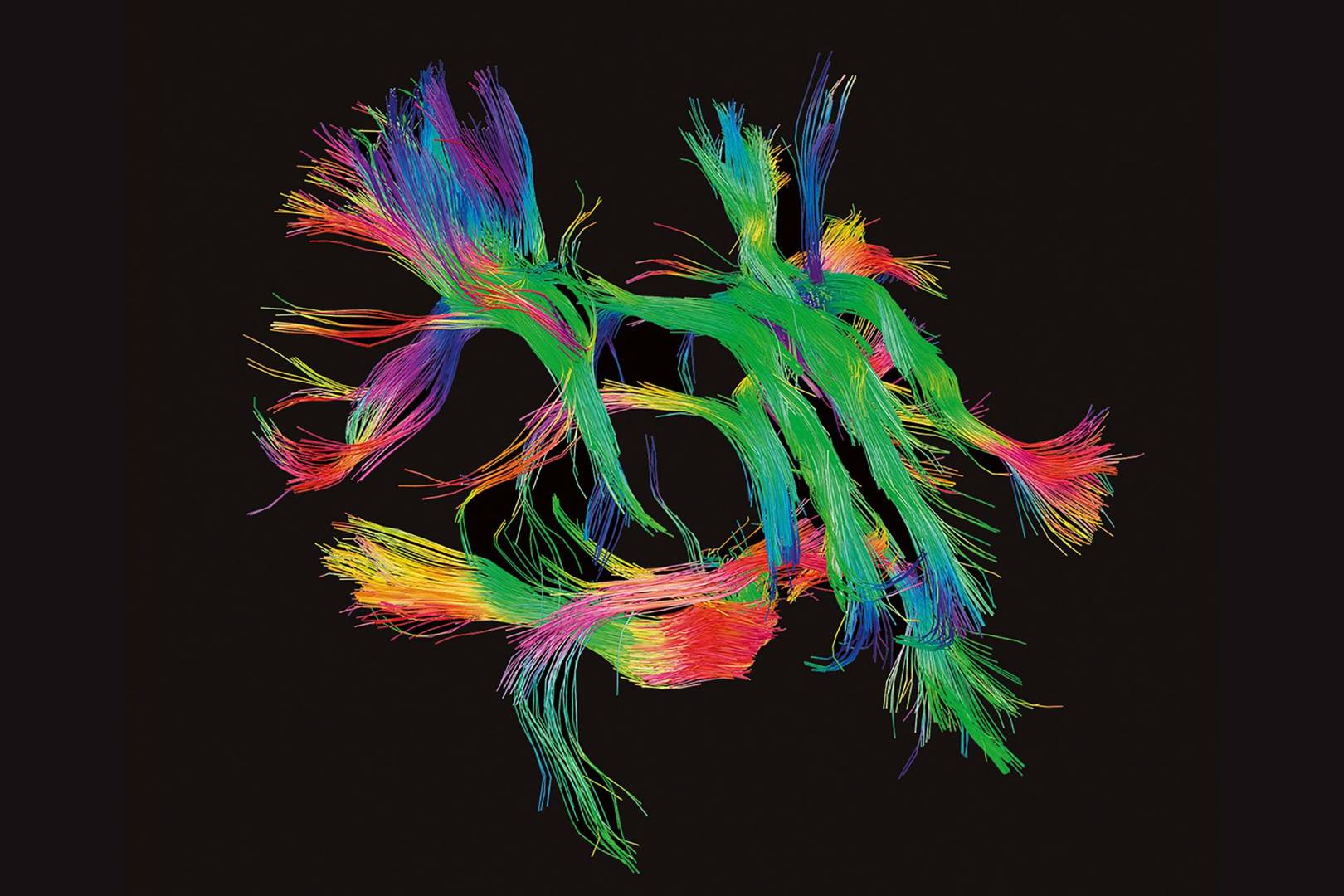 Not so grey matter! Brain scans are transformed into beautiful and sprawling works of neon art