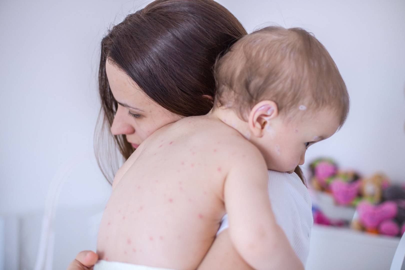 European measles outbreak puts all countries at risk