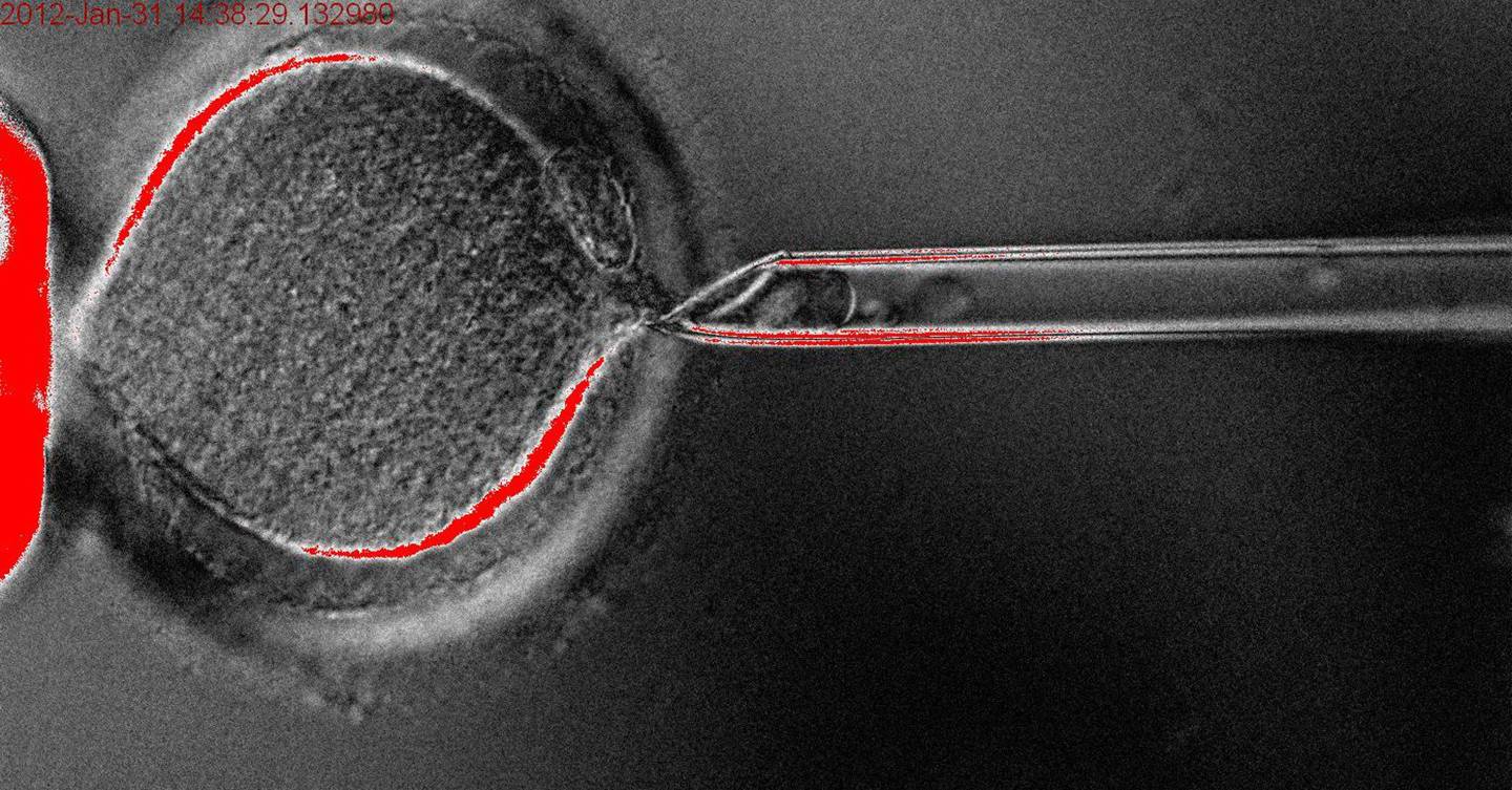 Human stem cells successfully cloned for the first time WIRED UK