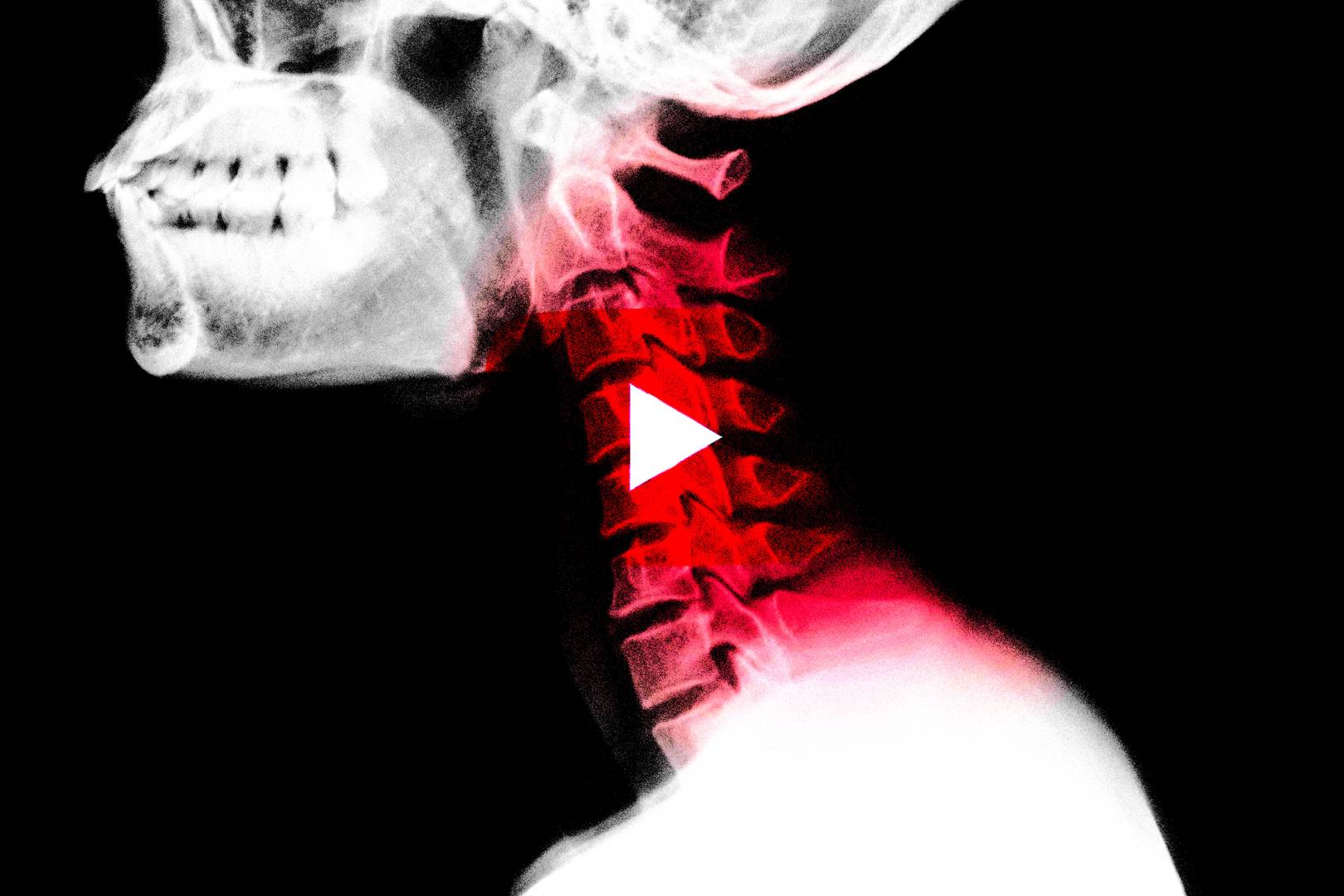 Crack addicts are turning YouTube chiropractors into huge viral stars