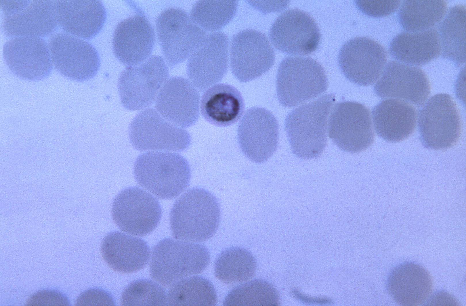 Scientists develop a malaria vaccine that works 100% of the time in limited trials