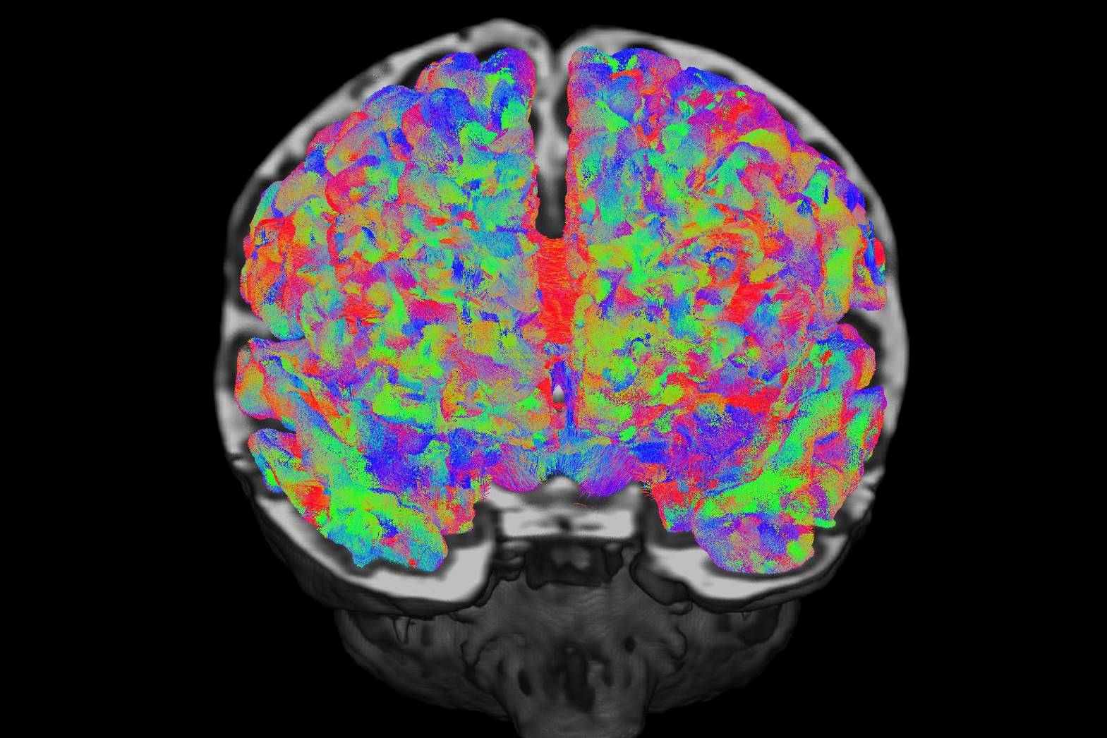 From womb to world: scans capture how our brains develop during pregnancy and beyond